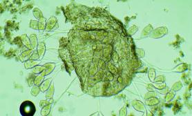 Pierwotniaki w osadzie czynnym